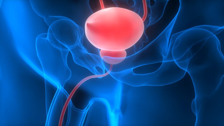 Trending With Impact: Novel Biomarkers in Bladder Cancer | Oncotarget