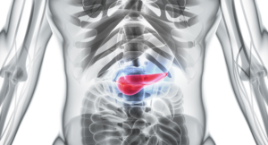 Novel Triple-Drug Combination to Fight Pancreatic Cancer